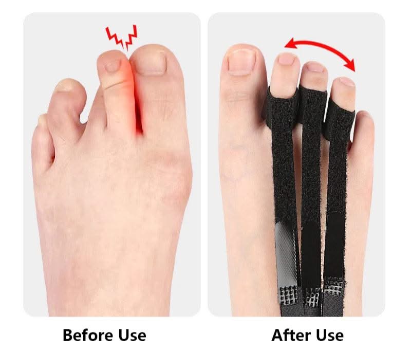Easevora Bunion & Toe Comfort product image 4