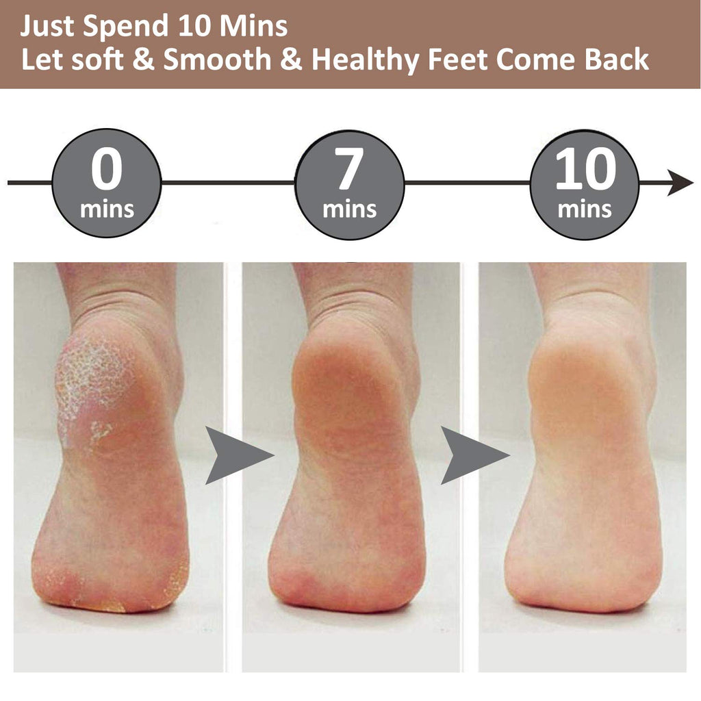 Easevora Foot Care Accessories product image 7